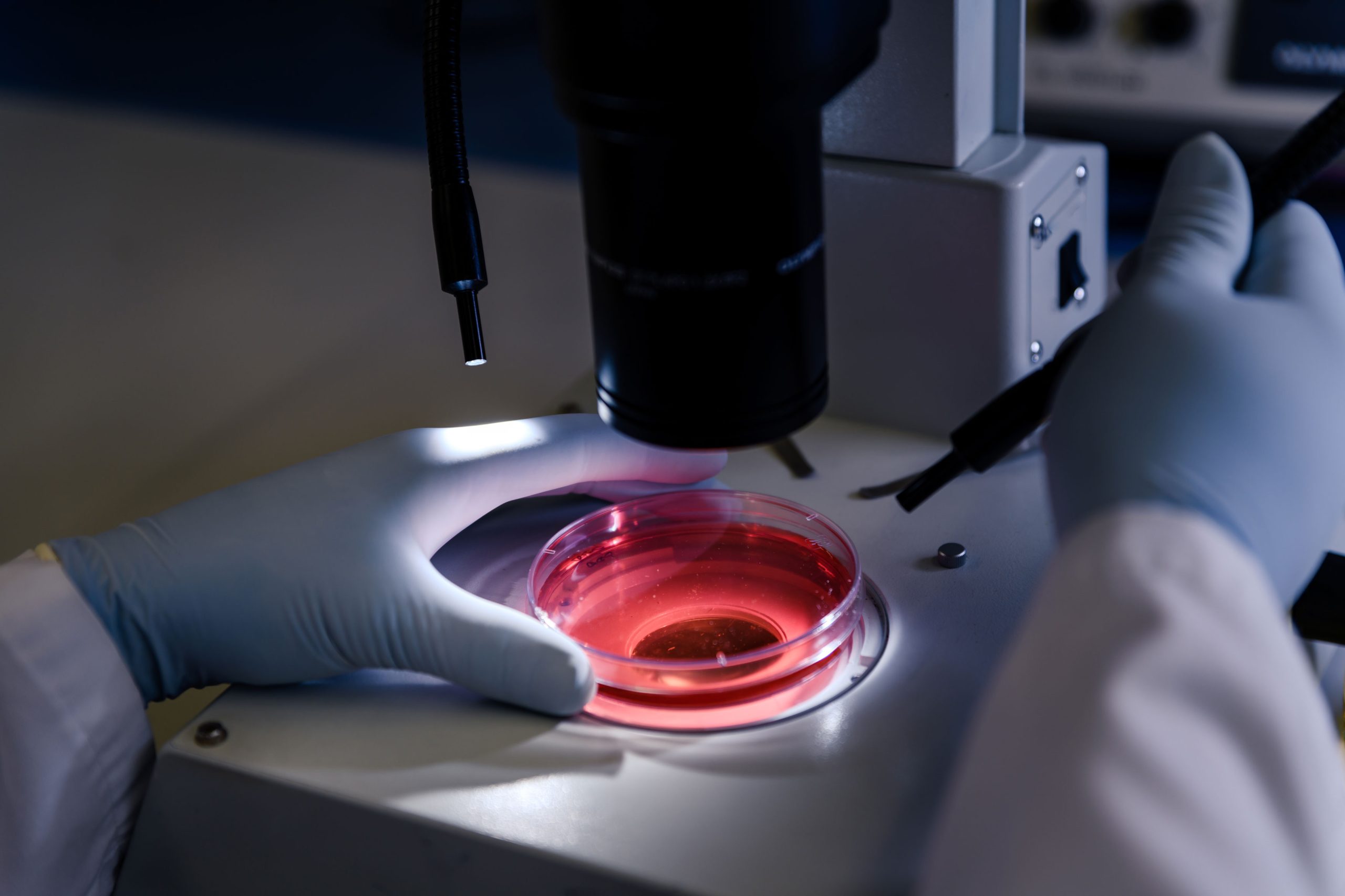 Ipertermia contro il cancro